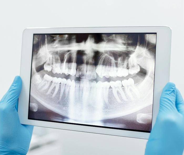 endodonzia
